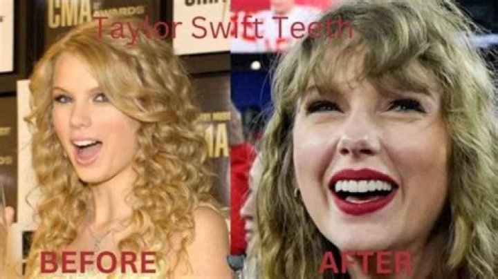 Flashes Smile After Taylor Swift’s ‘Gorgeous’ – Hollywood Life