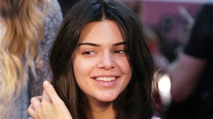 How To Deal With Stress Acne Like Kendall Jenner: Dermatologist Reveals How To Make It Better