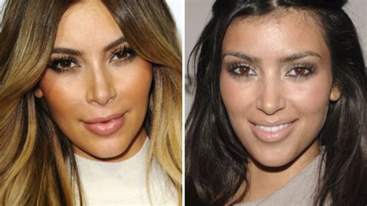 Kim Kardashian: Botox Overload Or Stunning?